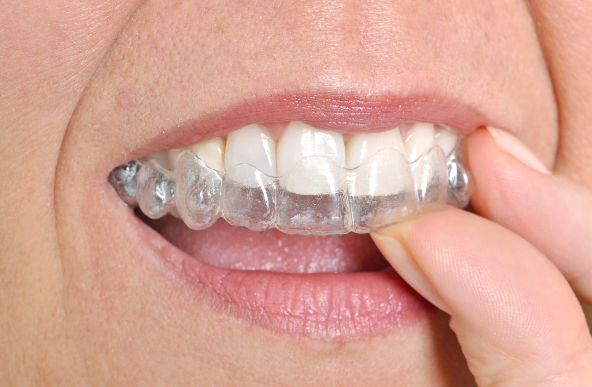 Reasonable Aligners